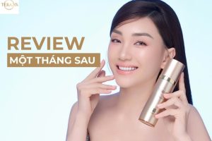 Người dùng Ngọc Tuyết: Hành trình hồi sinh làn da tuổi 30+ cùng review Serum Collagen TERA20’s
